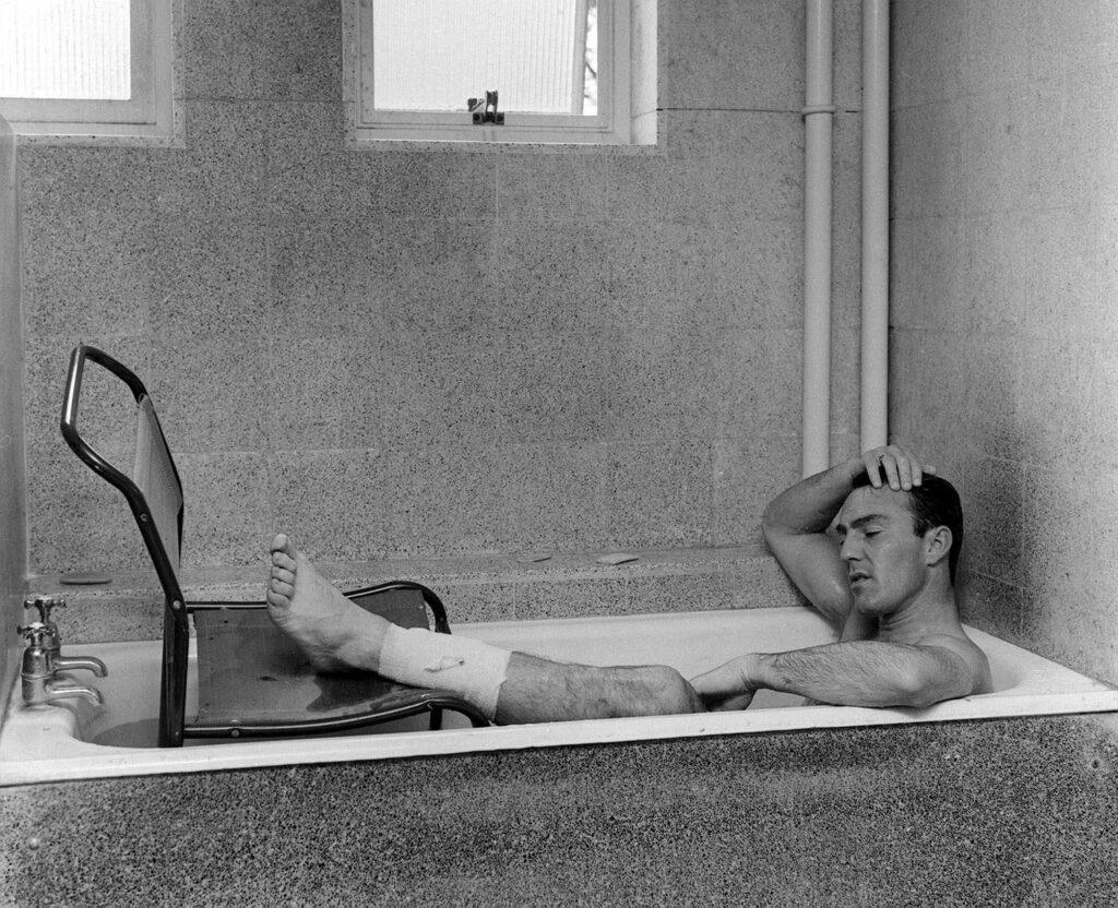 El jugador de fútbol inglés, Jimmy Greaves, descansa en una bañera llena de agua, con la pierna izquierda vendada y en alto, sobre una silla, después de haberse lesionado en el partido entre Inglaterra y Francia en la fase de grupos, por el que tuvo que que recibir tres puntos y perderse el resto del torneo.
